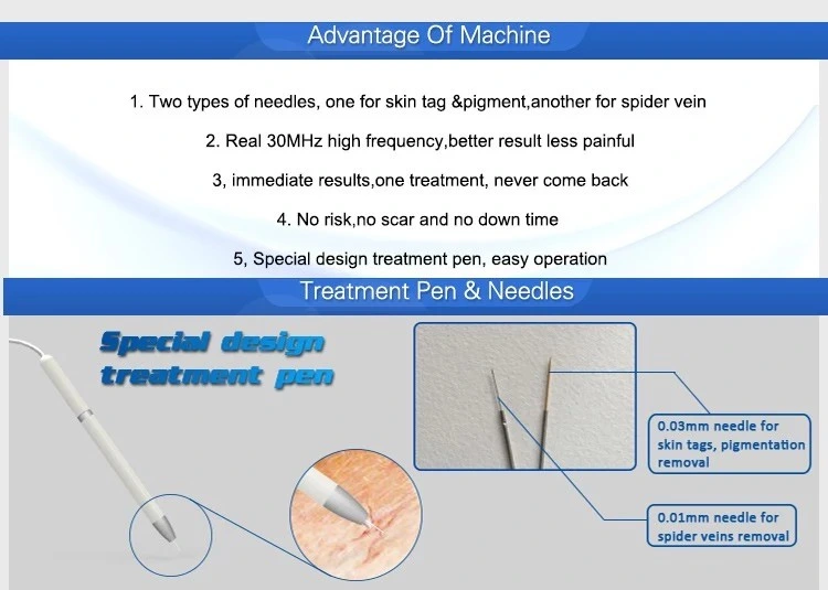 30MHz Rbs Vascular Surgical Vascular Spider Vein Removal Beauty Machine Acne Treatment Vascular Removal Rbs